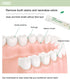 Travel Size Mouthwash Packets, Mini Mouthwash for Fresh Breath (Pack of 20)