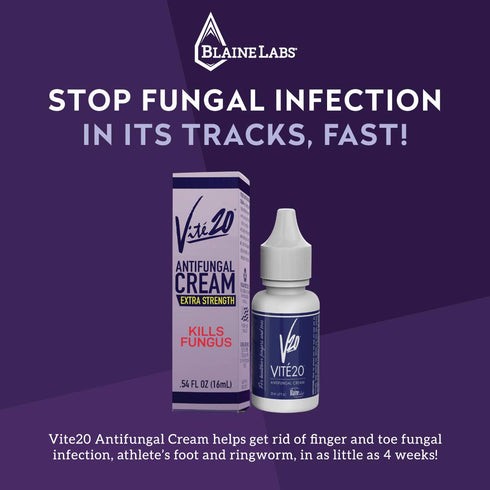 VIT20 V20 20 Vite Antifungal Cream Fungus Killer Hand and Feet Nail Treatment