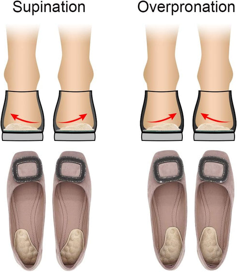 Dr. Foot's Corrective Shoe Inserts - Supination & Over-Pronation Medial & Lateral Heel Wedge Insoles, 3 Pairs Beige