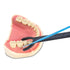 SDFlosser SDF Delivery System, Trial Pack