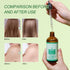 LIYALAN Pure Castor Oil - Cold Pressed Unrefined Hair Oil for Thicken Hair, Nourish Hair & Scalp, Glass Bottle, 3.38 fl