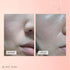 NUBORN CELL Hydrogel Collagen Mask, Advanced Stem Cell Hydrogel Sheet Face Mask for Dry Skin, 4-Pack