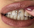 Sweet Smile | The ALL IN ONE DIY Tooth Gem Kit | Gold, Multi-Color, Clear Crystal Gems | Tooth Jewelry | Heart, Star