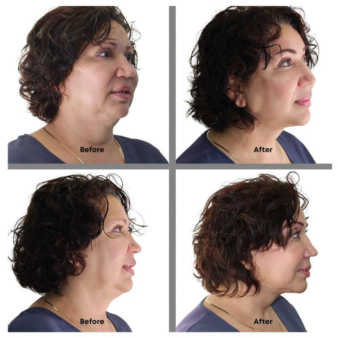 Instant Face Lift Tape Kit - 30-Day Supply of Transparent Neck & Eyebrow Lift Strips - Made in USA