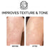 Keratosis Pilaris Exfoliating Body Lotion – 12% Lactic Acid for Gentle Exfoliation & Moisture