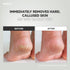 Wide Emery Foot File (Pink) - Double-Sided Pedicure Tool for Cracked Heels and Callus Removal