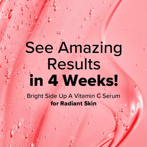 I DEW CARE Vitamin C Face Serum - Bright Side Up, Hydrating with Niacinamide, Korean Glass Skin Care, Non-irritating,