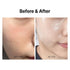 Wrinkle Fit Mesh Sheet Masks + Boosting Roller (Mask 7EA + Roller 1EA) - Collagen Mask, Quick Absorption, Anti-aging