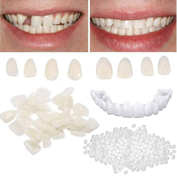 Tooth Repair Kit for Fixing Missing, Chipped, and Broken Tooth Gap with Thermal Beads and Fake Teeth Brace Mold