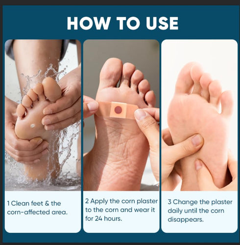 kindshine 96P 40% Corn Remover Pads for Feet and Toes, Extra Strength Salicylic Acid Medicated Patches, Effective