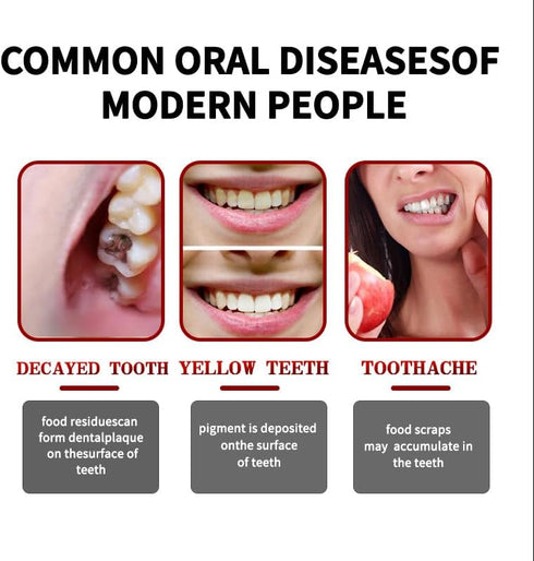 JISKG SP10 Probiotic Whitening Toothpaste, Deep Cleaning Care Remove Yellow Tooth Stains, with Probiotic Oral Health