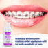 EverSmile OrthoFoam Braces Cleaner - Cleans Under Brackets & Wires, Foaming Bubbles Whiten Teeth (25ml - 2pk)