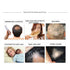 Natural Hair Growth Serum Ginger Essential Oil Hair Growth Oil Anti Hair Loss Essence Hair Thinning Treatment Healthy Strong Thick Hair Treats Baldness Weak Brittle Thinning Hair