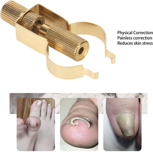 Ingrown Toenail Lifter, Stainless Steel Nail Corrector Tool for Curved Ingrown Toenails, Foot Care Pedicure Tool (Gold)