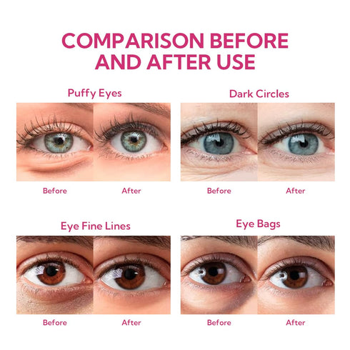 BREYLEE Rose Eye Mask 60 Pcs, Under Eye Patches,Eye Patches For Puffy Eyes,Hydrates, Improves And Firms The Eye Area, Suitable For Both Women And Men.