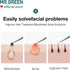 MR.GREEN Ingrown Hair Tweezers - Needle Nose Pointed Tips for Eyebrows, Splinters, Blackhead Removal