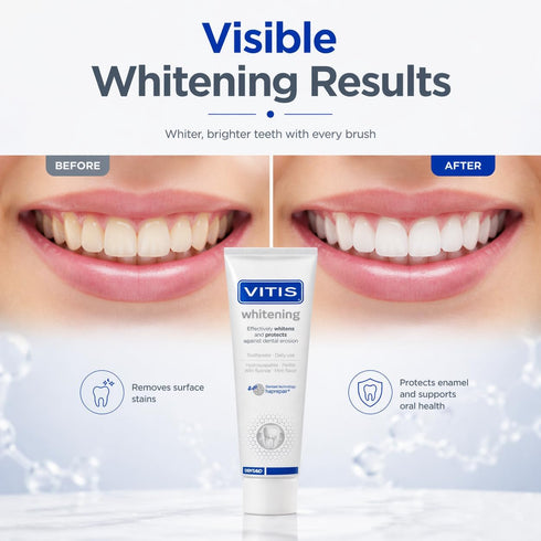 Vitis 100ml Whitening Toothpaste