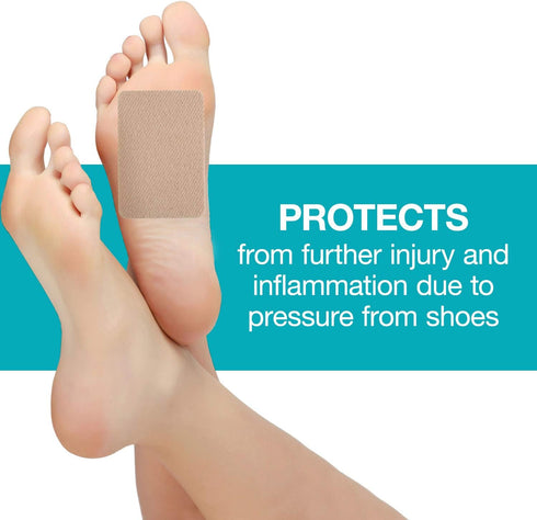 Steins Moleskin Foot Blister Heel Pads, Tan, 2" x 3", 100 Count with Adhesive Backing