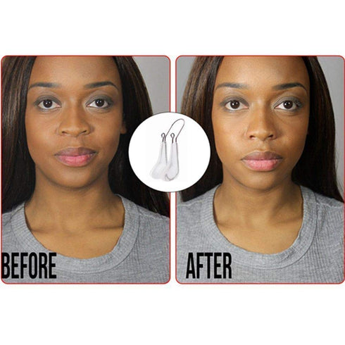 Lenlorry Nose Shaper Clip, Unisex Rhinoplasty Tool, Soft Silicone Nose Lifter and Slimming Device