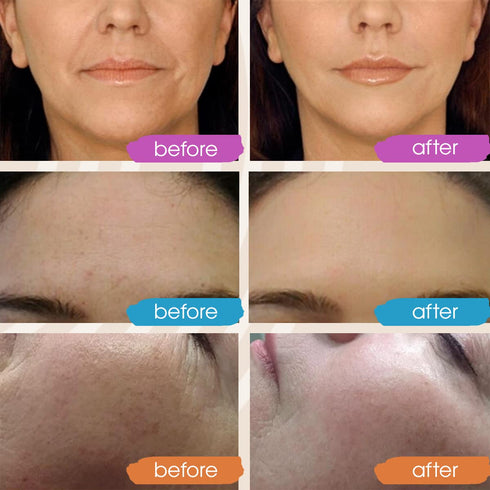 Retinol Serum for Face - Vitamin C and Hyaluronic Acid Serum, Glow Face Serum for Women and Men, 3x1oz