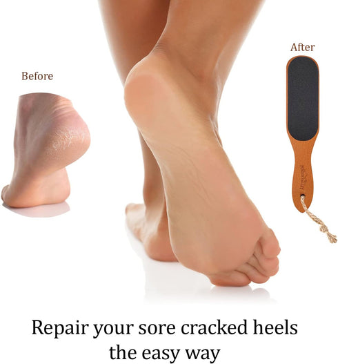Pumice Stone Foot File, Wooden Pedicure Scrubber with Handle for Callus and Dead Skin Removal