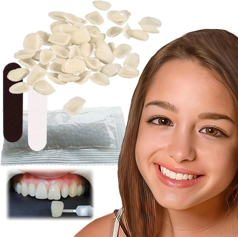 VEZE Tooth Repair Kit, Thermal Fitting Beads and Fake Teeth for Temporary Fixing Missing Tooth, Yellow