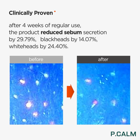 P.CALM Barrier Cycle Toner 200ml | Vegan Alcohol-Free Toner for Sensitive Skin | Korean Skincare