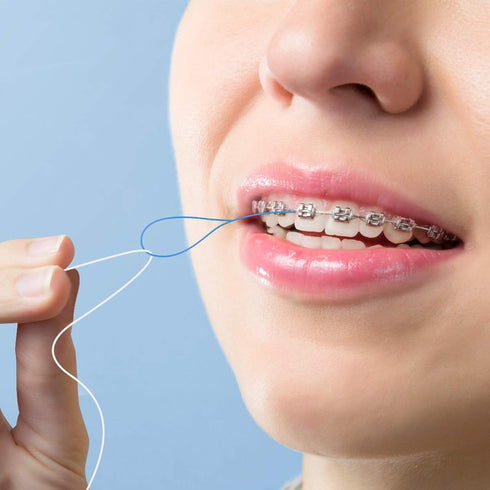 Floss Threaders for Braces, Bridges, and Implants, 50 Count (Pack of 3)