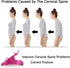 Xemz Cervical Neck Traction Massage Device, Silicone Massage Ball Trigger Point Therapy Tension Headache Relaxer Back