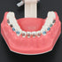 Dental Models Orthodontic Model M7010-2, 1:1 Standard Typodont Teeth with Archwire Ligature Ties, Metal Brackets