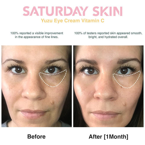 Saturday Skin Yuzu Eye Balm, Vitamin C Illuminating Under Eye Cream, Korean Niacinamide for Wrinkles, Dark Circles