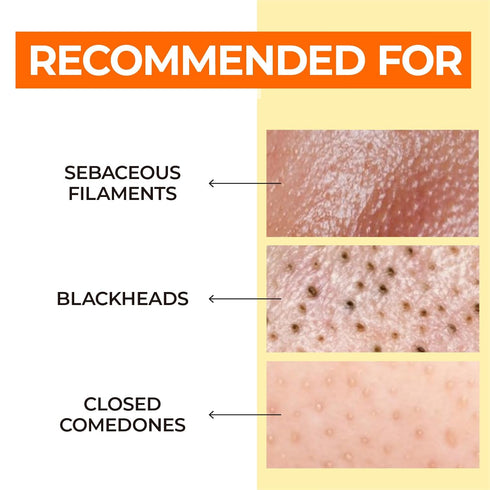 numbuzin No.1 Easy Peasy Cleansing Oil | Makeup Removing Facial Cleanser, Unclogs Pores, Blackheads Removal, Non-heavy,