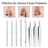 Pinkiou Blackhead Removers | 8-in-1 Acne Extractor Tool Kit for Face and Nose | Blemish Removal Skincare