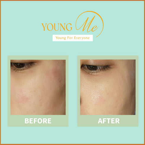YoungMe Soothing Glam Facial Sheet Mask, 6 Sheets for Sensitive Skin, Korean Skin Care, Deep Real Mask