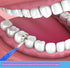 50 Pcs Interdental Brushes in 4 Sizes, Dental Soft Toothpicks for Braces, Oral Hygiene Slim Cleaning Tool
