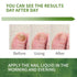 NOXYRAL 7 Toenail Fungus Treatment Extra Strength: Pure Natural Plant ExtractsToe & Fingernail Fungus Renewal - Nail