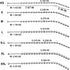 Rovamvia Urethral Sounds Beads Plug, Sex Toy of Penis Plug Urinary Dilator Urethral Stimulation Masturbation Rod
