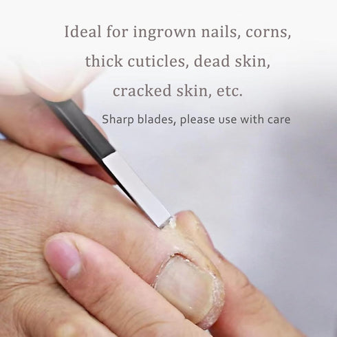 Professional Pedicure Knife Set, Callus Knife for Feet, Ingrown Toenail Knives, Foot Care Tools