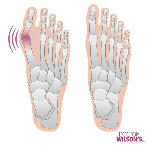 2 Bunion Relief Pads Sleeve - Orthopedic Bunion Corrector Socks, Gel Pad Cushions for Men and Women (1 Pair)
