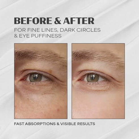 Mens Anti Aging Face Cream | Advanced Facial Moisturizer for Men | Mens Anti Wrinkle Face Cream | Mens Anti Aging Face Cream with High Concentrate of Natural Ingredients | Mens Retinol Face Cream for Intensive Skincare | Mens Wrinkle Cream with Age-Defyin