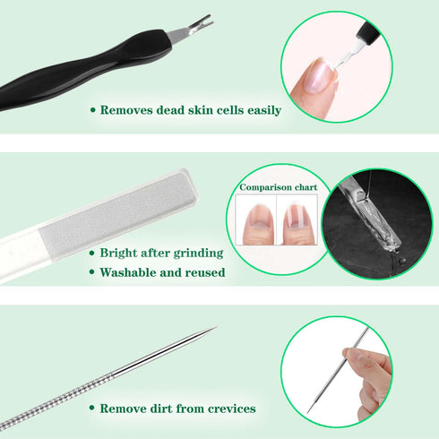 Ingrown Toenail Pedicure Tool Kit, 11 Piece Stainless Steel Nail Care Treatment for Nail Correction and Pain Relief