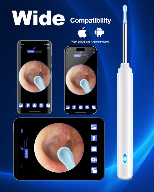 Ear Wax Removal Tool Camera, Ear Cleaner with Camera, Ear Cleaning Kit 1296P HD Ear Scope with 6 LED Lights and 6 Ear