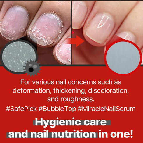 Safe Pick Miracle Nail Serum 17ml