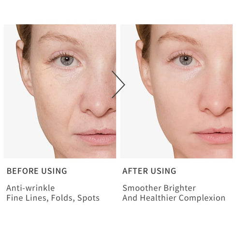 Vitamin C Serum for Face, Anti-Aging with Hyaluronic Acid, Reduces Wrinkles and Dark Spots, Retinol Serum