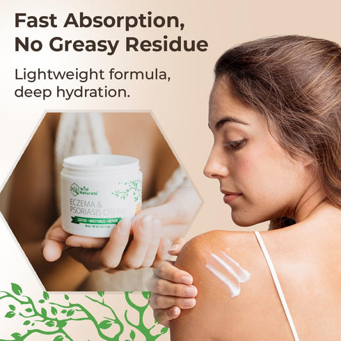 Wild Naturals Eczema & Psoriasis Cream for Dry, Itchy Skin Eczema Relief for Adults & Kids Moisturizing Psoriasis Cream