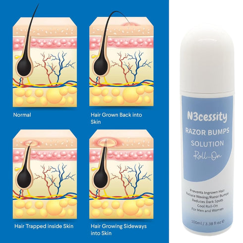 Razor Bumps Treatment for Women and Men, Ingrown Hair Treatment for Bikini, Face, Neck, Legs