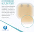 Dynarex DynaDerm Hydrocolloid Dressing, Sterile Moist Bandages, 2" x 2", Pack of 20, Latex-Free