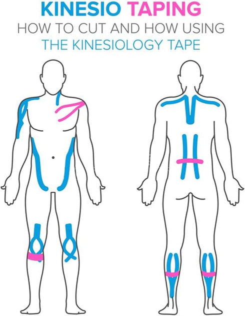 Kinesiology Tape (20 Precut Strips), Pro Elastic Athletic Tape for Joints Support & Muscle Pain Relief (Skin Color)