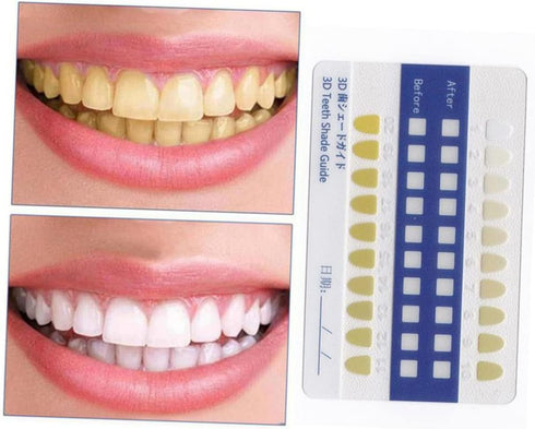 Ipetboom 20-Piece Set PVC Tooth Shade Comparison Chart Matte Finish Tooth Color Contrast Cards for Whitening Supplies