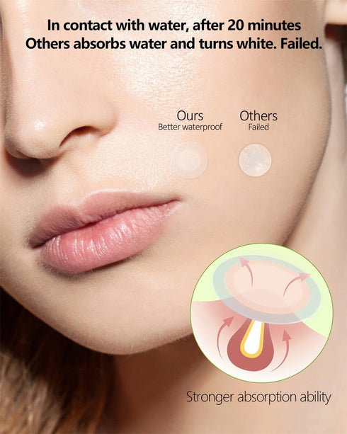 Pimple Patches for Face 66 Counts, 2 Sizes Thinner Edge Hydrocolloid Acne Patches for Invisible Zit Treatment